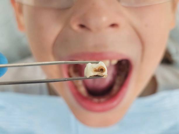 Best Emergency Dental Services for Seniors in Kirby, TX